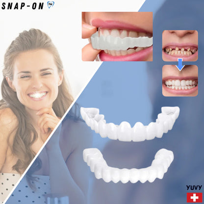 SnapOn™ Top and Bottom Veneer Set - Transform Your Smile in Seconds