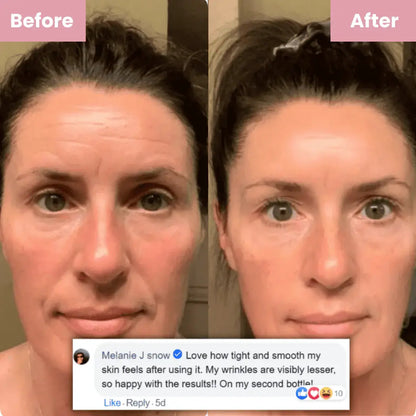 GlowShield™ - Wake Up Looking 10 Years Younger - Or Your Money Back