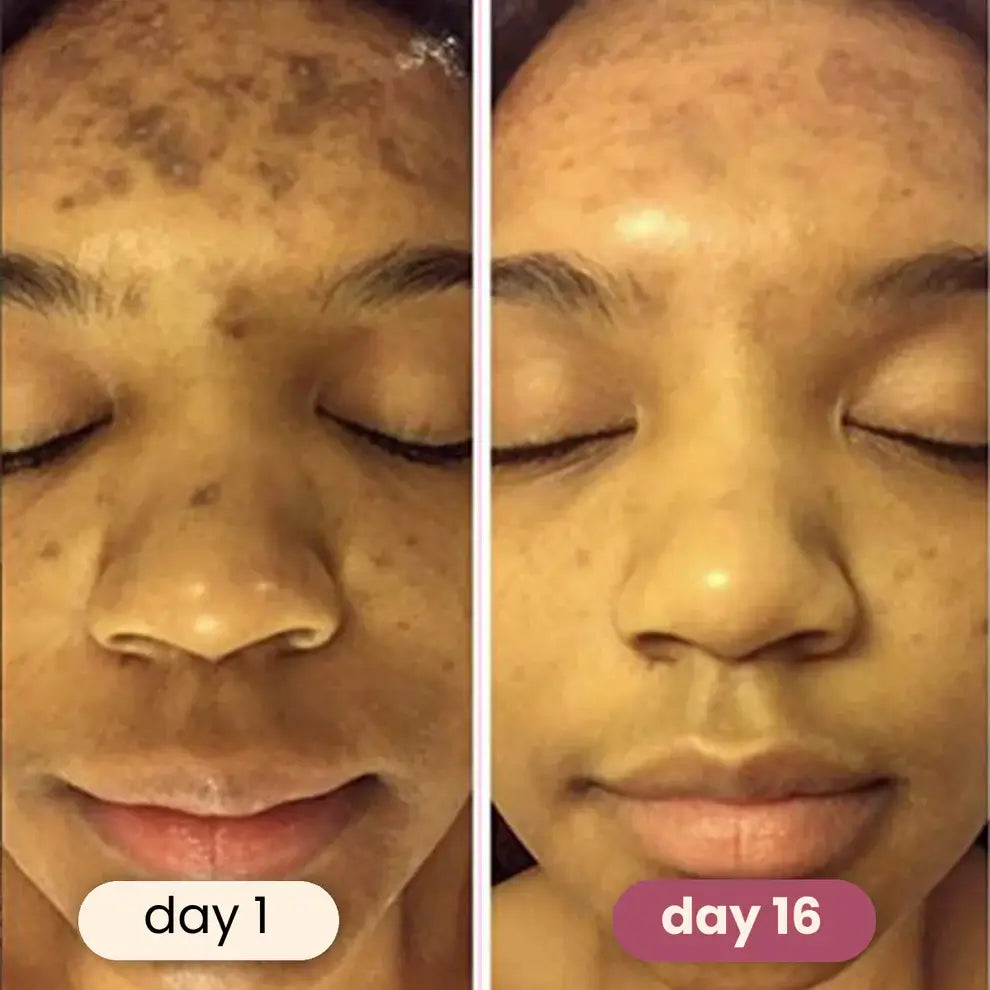 YUVY™ Brightening Turmeric & Kojic Acid Pads